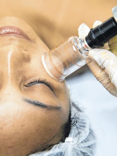 ventosa facial